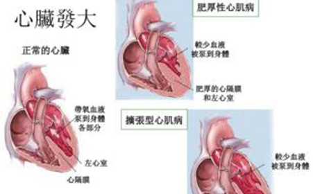 病毒性感染的心肌炎严重吗_全面解答解释落实